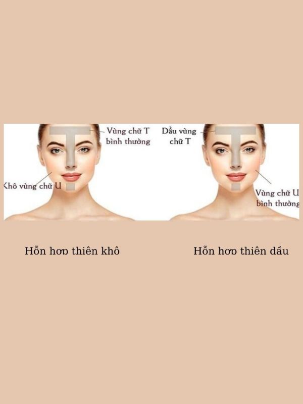 Nhận biết da hỗn hợp