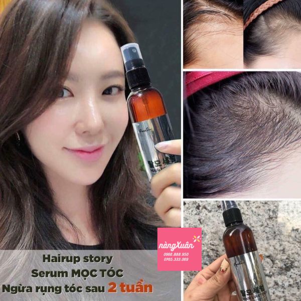 Tinh Chất Mọc Tóc Dạng Xịt GENIE Hair Up Story Paris Choi 100ml