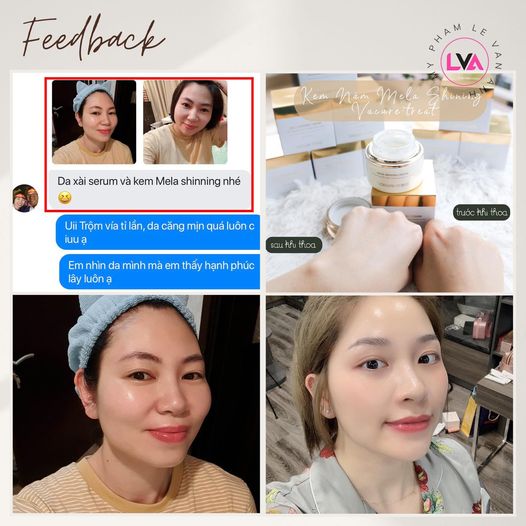 Feedback khách sử dụng kem nám Vacure:treat